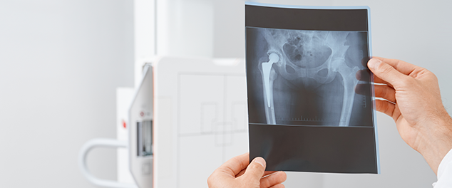Ortopeda oglądający RTG miednicy.